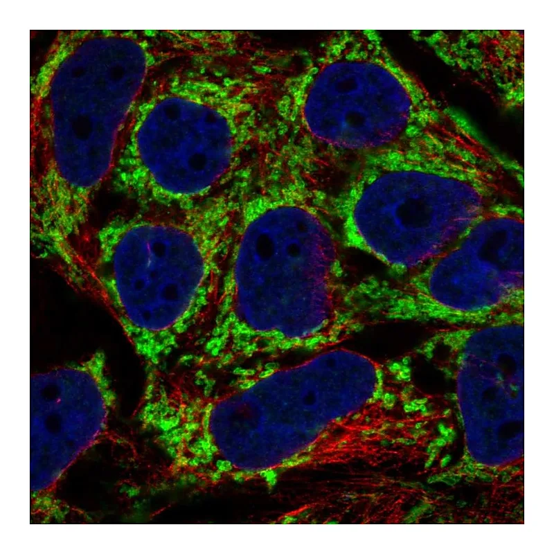 Atlas Antibodies Anti-AKAP1 Antibody