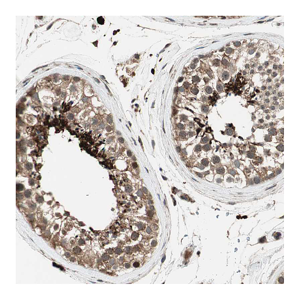 Atlas Antibodies Anti-AKAP1 Antibody