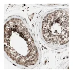 Atlas Antibodies Anti-AKAP1 Antibody