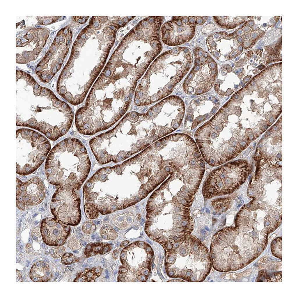 Atlas Antibodies Anti-AKAP10 Antibody