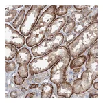 Atlas Antibodies Anti-AKAP10 Antibody