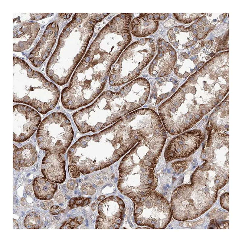 Atlas Antibodies Anti-AKAP10 Antibody