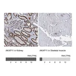 Atlas Antibodies Anti-AKAP11 Antibody