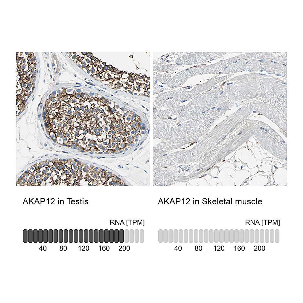 Atlas Antibodies Anti-AKAP12 Antibody