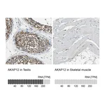 Atlas Antibodies Anti-AKAP12 Antibody