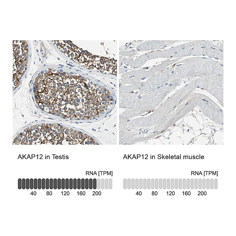 Atlas Antibodies Anti-AKAP12 Antibody