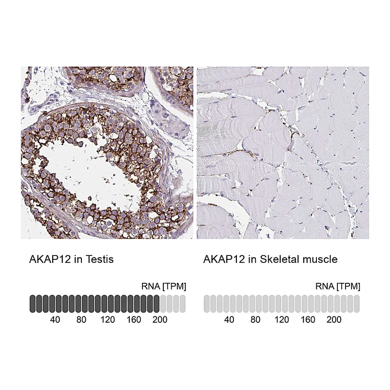 Atlas Antibodies Anti-AKAP12 Antibody