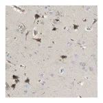 Atlas Antibodies Anti-AKAP13 Antibody