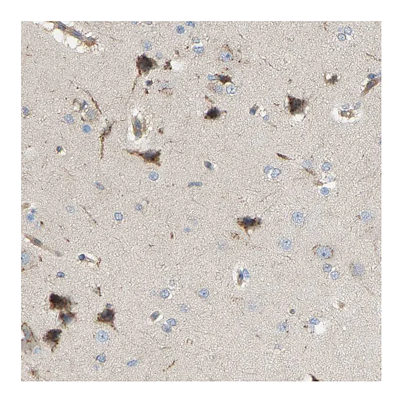 Atlas Antibodies Anti-AKAP13 Antibody