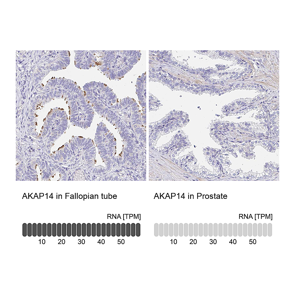 Atlas Antibodies Anti-AKAP14 Antibody