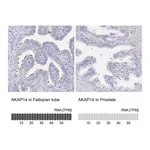 Atlas Antibodies Anti-AKAP14 Antibody