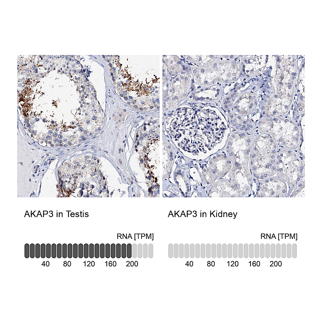 Atlas Antibodies Anti-AKAP3 Antibody