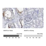 Atlas Antibodies Anti-AKAP3 Antibody