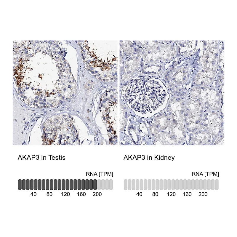 Atlas Antibodies Anti-AKAP3 Antibody
