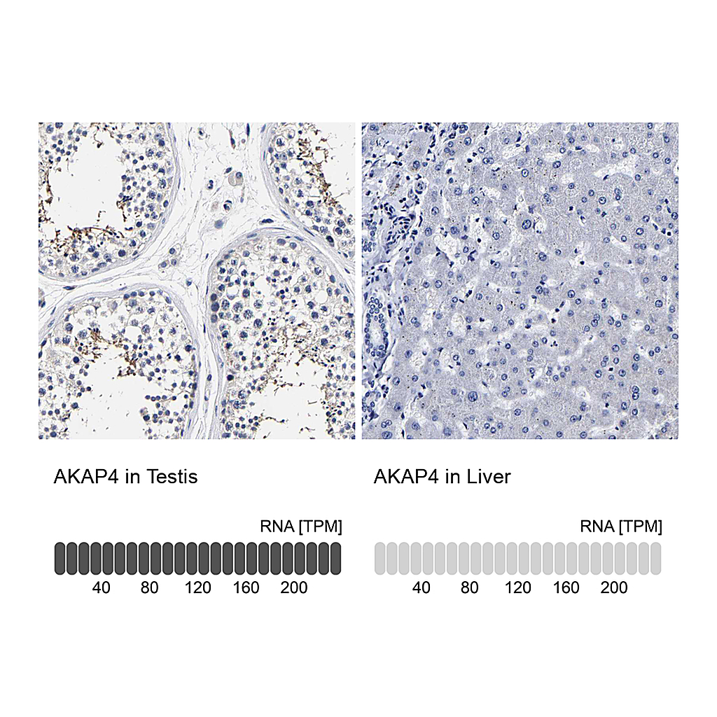 Atlas Antibodies Anti-AKAP4 Antibody