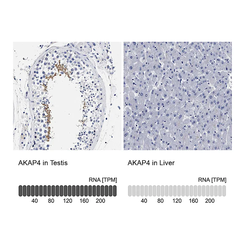 Atlas Antibodies Anti-AKAP4 Antibody