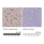 Atlas Antibodies Anti-AKAP5 Antibody