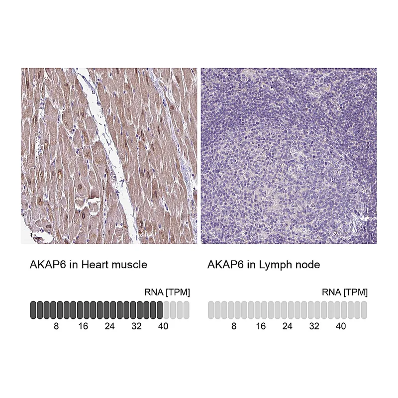 Atlas Antibodies Anti-AKAP6 Antibody