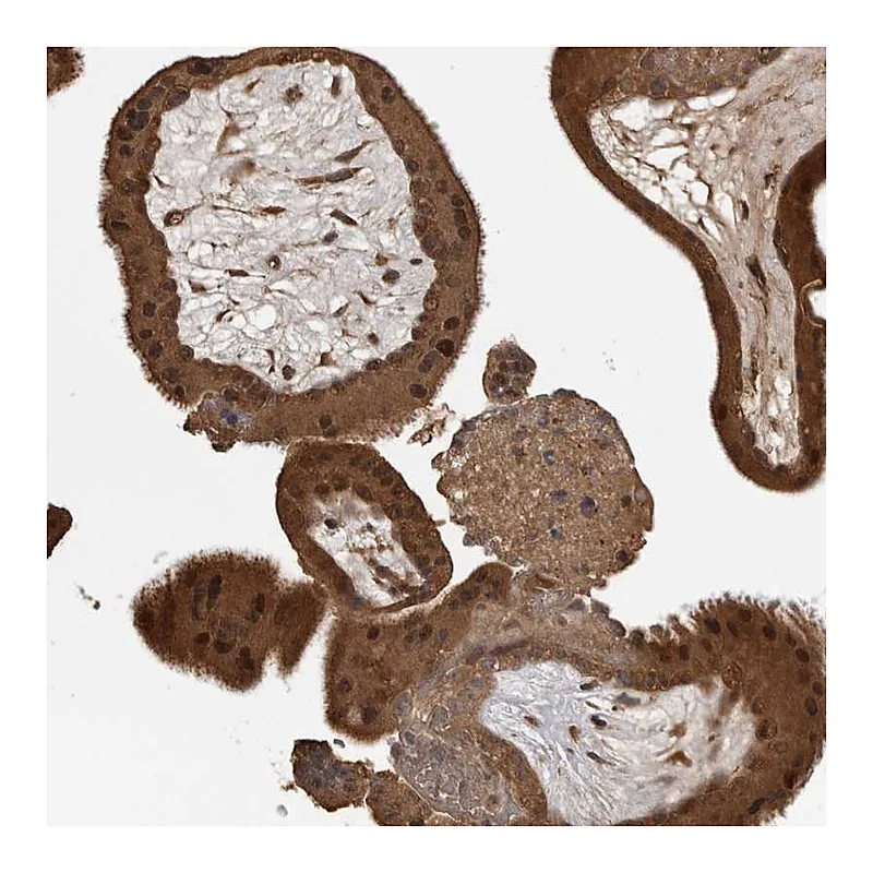 Atlas Antibodies Anti-AKAP7 Antibody