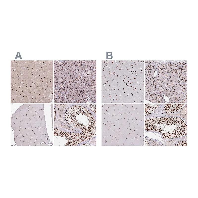 Atlas Antibodies Anti-AKAP8L Antibody