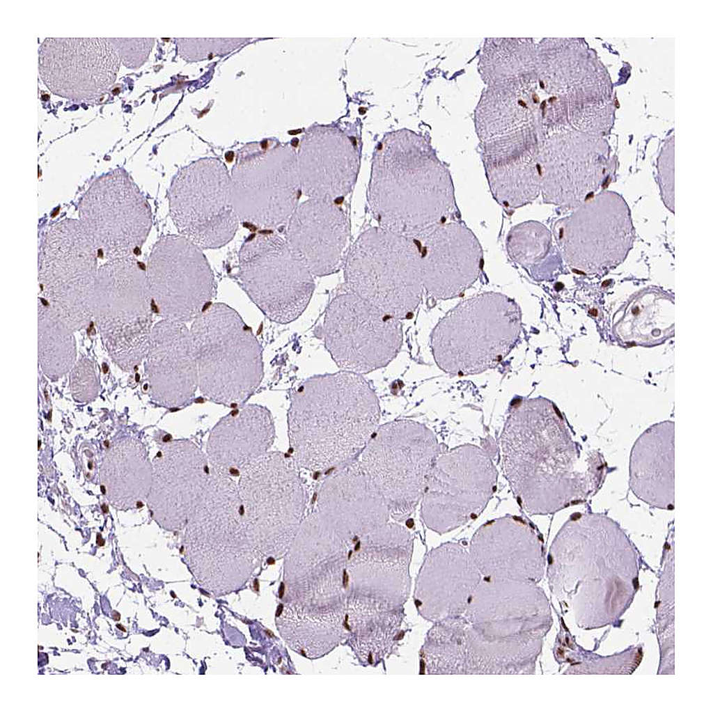 Atlas Antibodies Anti-AKAP8 Antibody