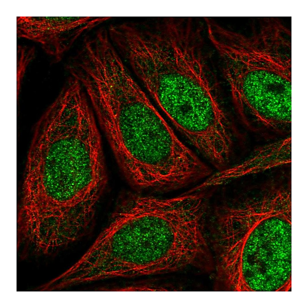 Atlas Antibodies Anti-AKIP1 Antibody