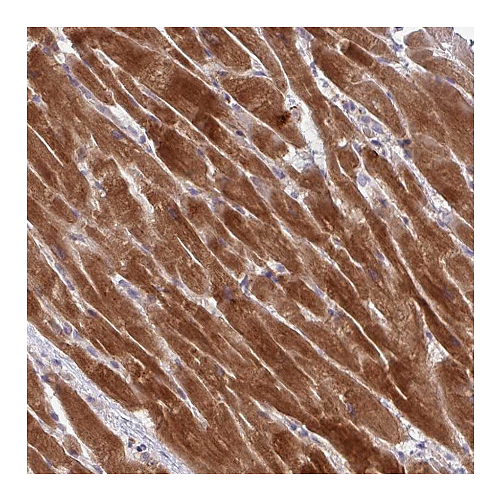 Atlas Antibodies Anti-AKIRIN1 Antibody
