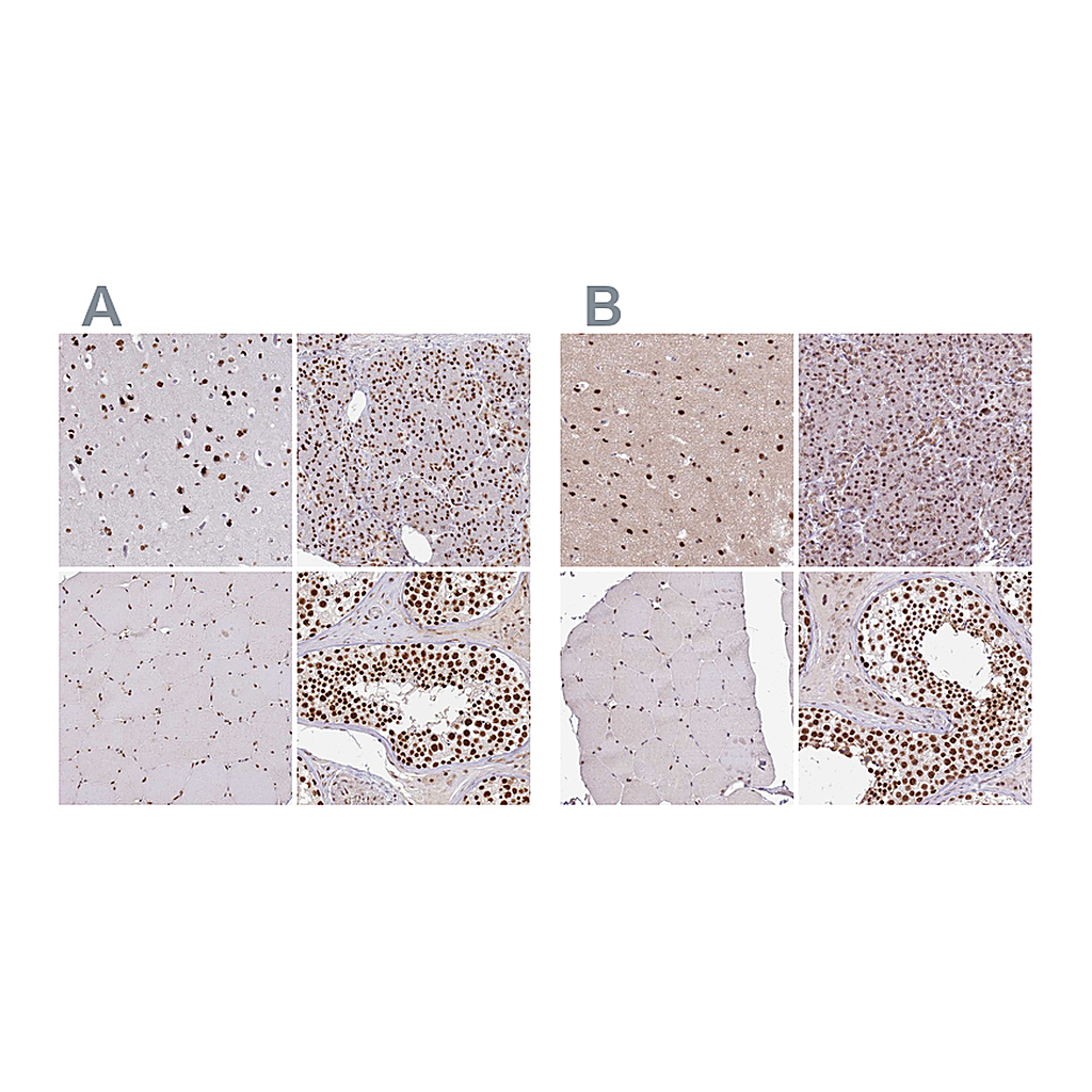Atlas Antibodies Anti-AKAP8L Antibody