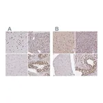 Atlas Antibodies Anti-AKAP8L Antibody