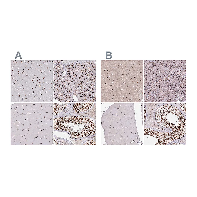 Atlas Antibodies Anti-AKAP8L Antibody