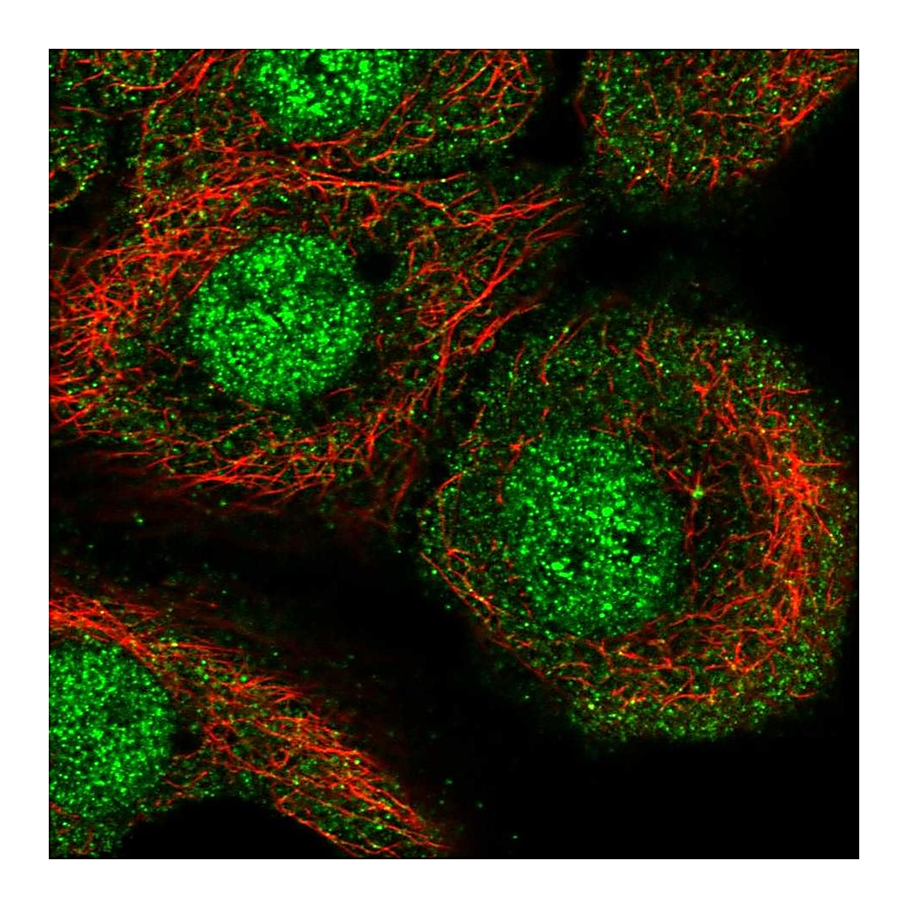 Atlas Antibodies Anti-AKNA Antibody