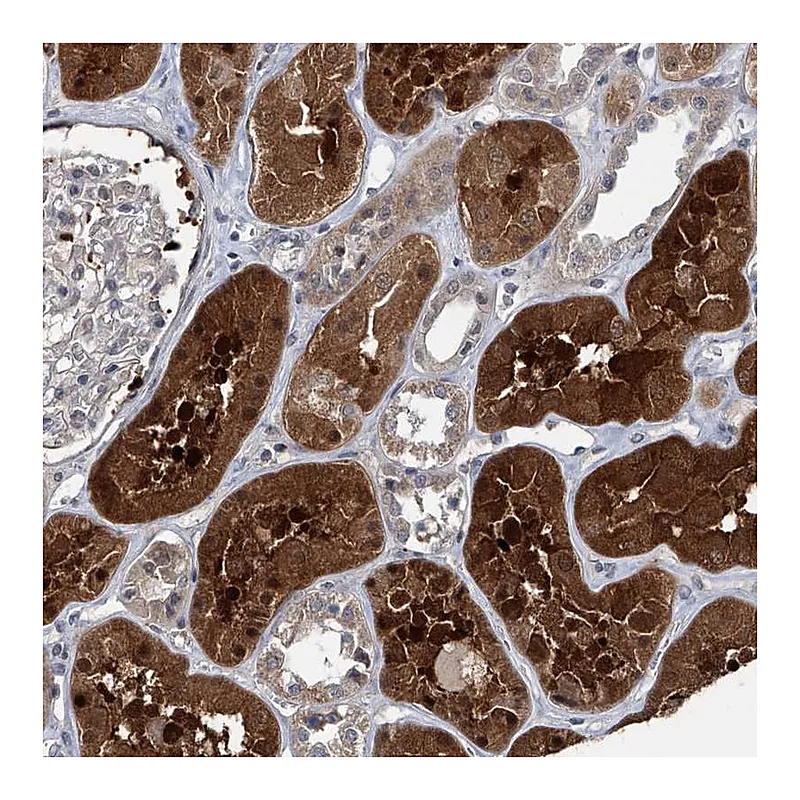Atlas Antibodies Anti-AKNAD1 Antibody