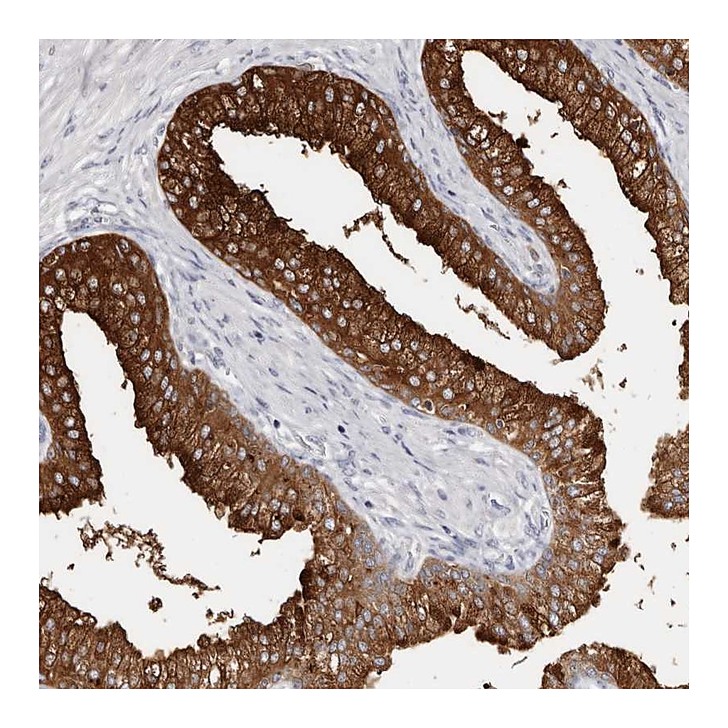 Atlas Antibodies Anti-AKNAD1 Antibody