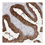 Atlas Antibodies Anti-AKNAD1 Antibody
