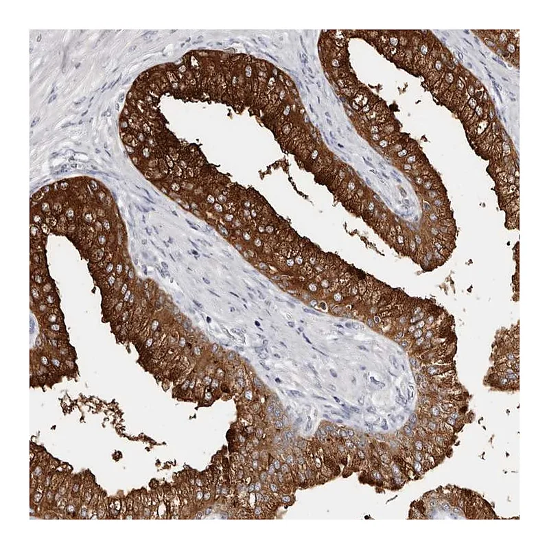Atlas Antibodies Anti-AKNAD1 Antibody