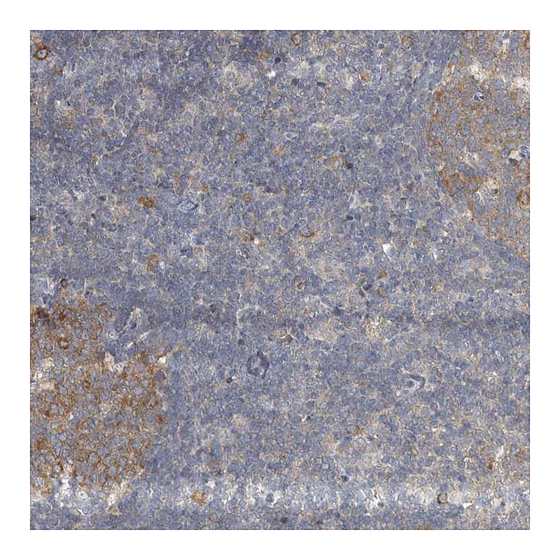 Atlas Antibodies Anti-AKNAD1 Antibody