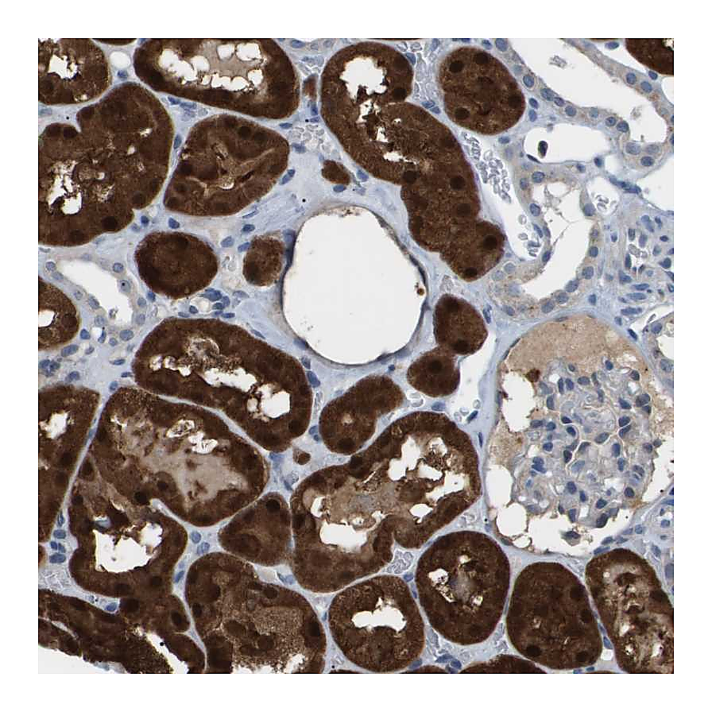Atlas Antibodies Anti-AKR1A1 Antibody