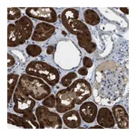 Atlas Antibodies Anti-AKR1A1 Antibody