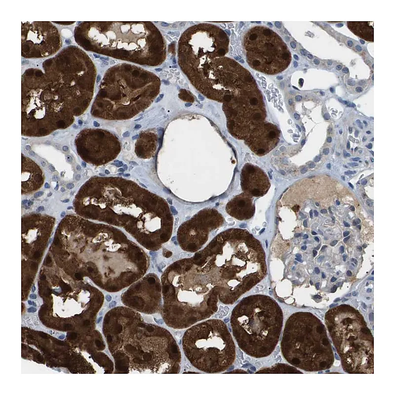 Atlas Antibodies Anti-AKR1A1 Antibody