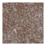 Atlas Antibodies Anti-AKR1A1 Antibody