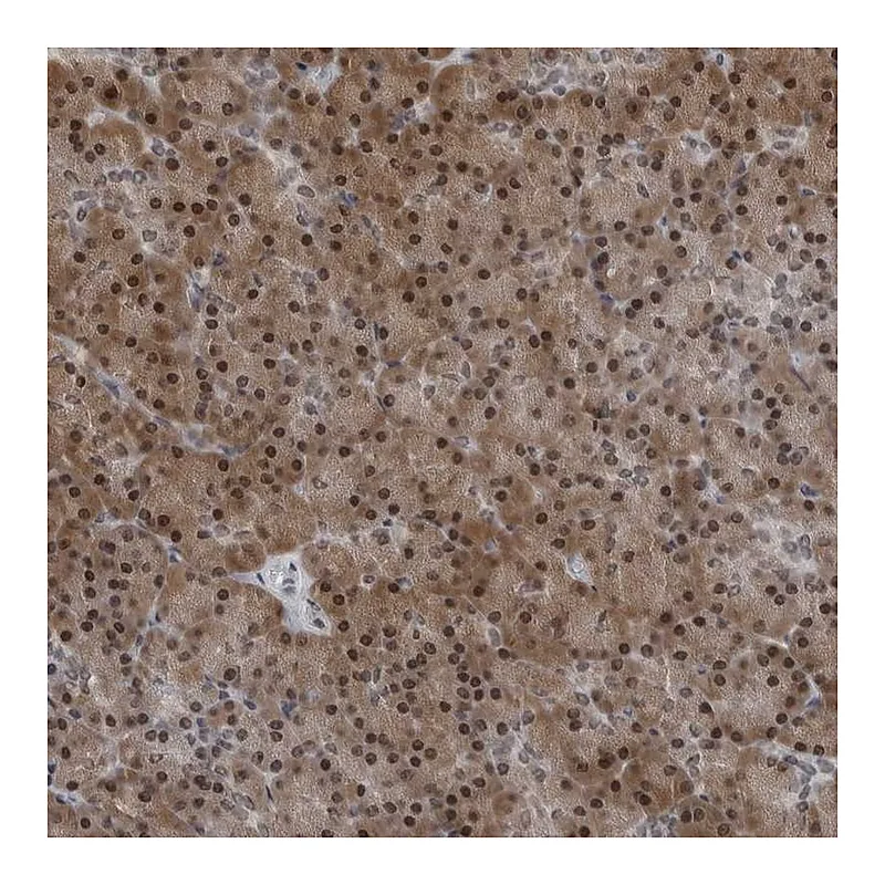 Atlas Antibodies Anti-AKR1A1 Antibody