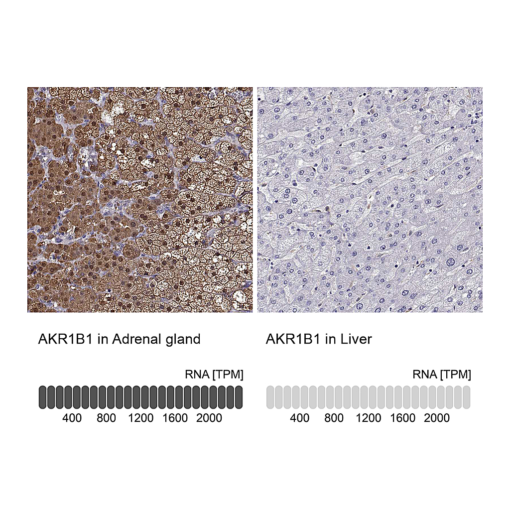 Atlas Antibodies Anti-AKR1B1 Antibody