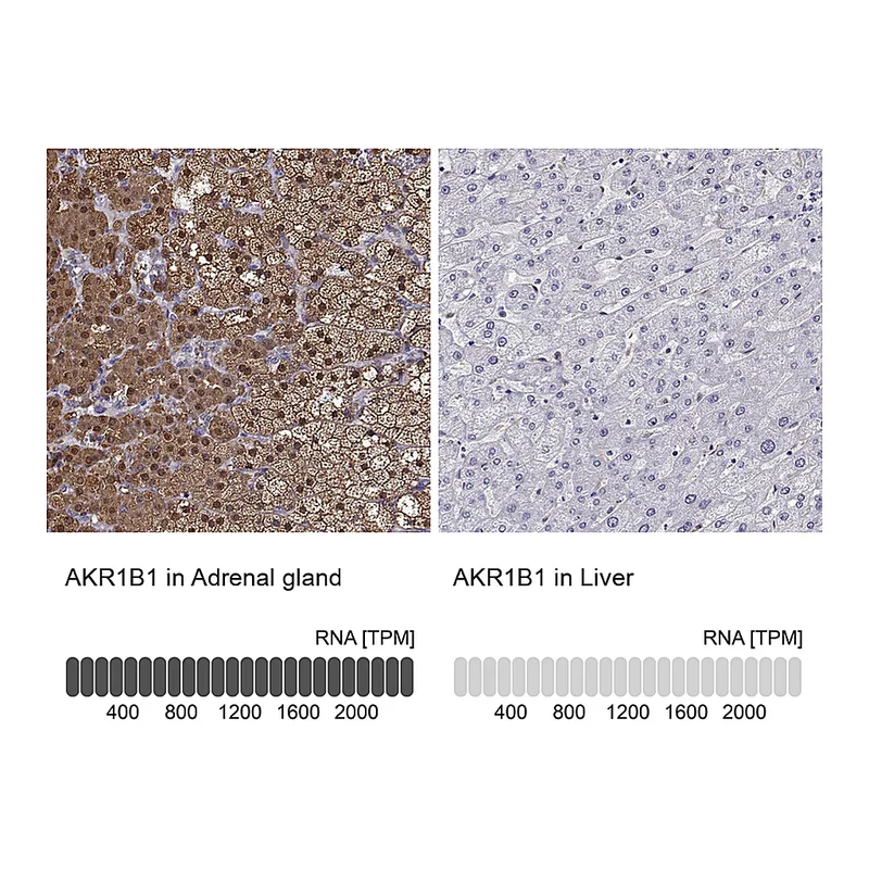Atlas Antibodies Anti-AKR1B1 Antibody
