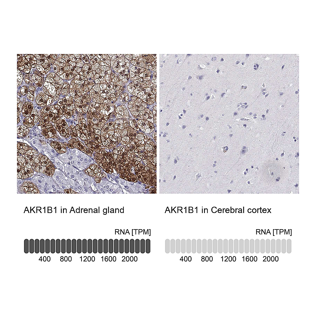 Atlas Antibodies Anti-AKR1B1 Antibody