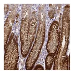 Atlas Antibodies Anti-AKR1B10 Antibody