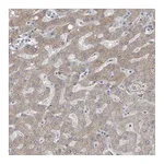 Atlas Antibodies Anti-AKR1C4 Antibody