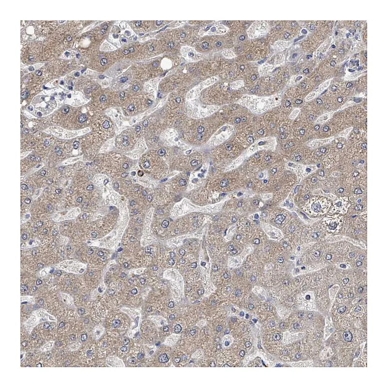 Atlas Antibodies Anti-AKR1C4 Antibody