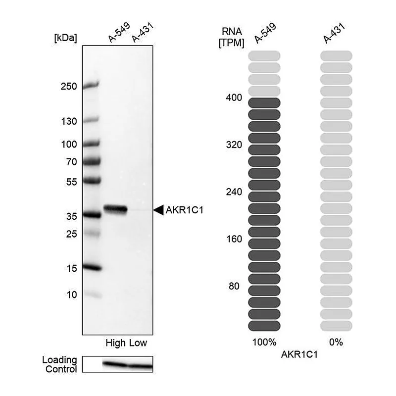Atlas Antibodies Anti-AKR1C1 Antibody