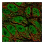 Atlas Antibodies Anti-AKR1E2 Antibody