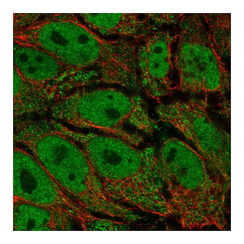 Atlas Antibodies Anti-AKR1E2 Antibody